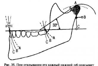 Внутриротовой метод регистрация центральною соотношения челюстей Сагиттальный суставной и резцовый пути